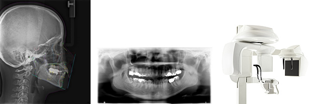 歯科用CT